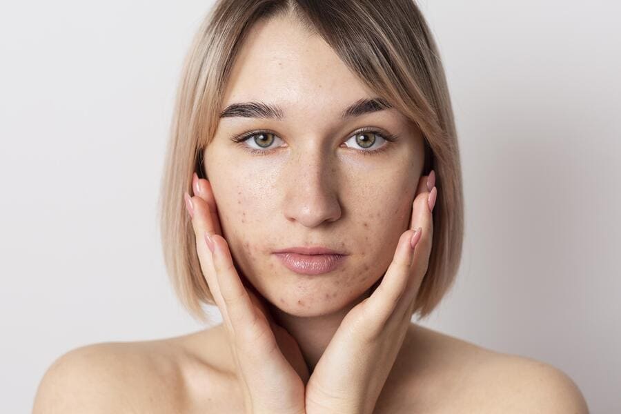 lears Dark Spots